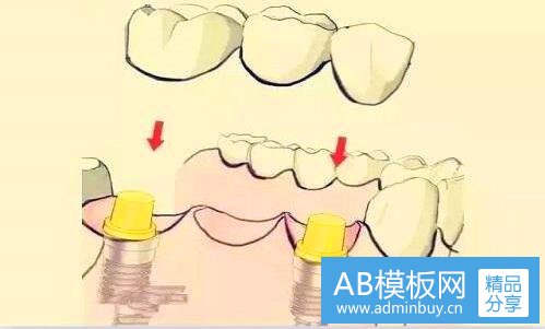 一施耐德开关
