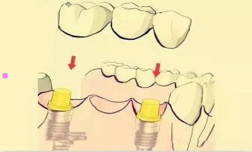 三水獭吃鳄鱼是真的吗