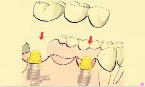 三叶集普高分数线